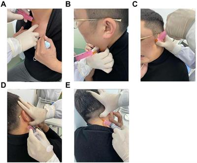 Latent myofascial trigger points injection therapy for adult cough variant asthma: A randomized controlled trial